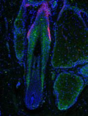 Miniaturized human hair follicle shows concentration of Prostaglandin D2 (in green).
